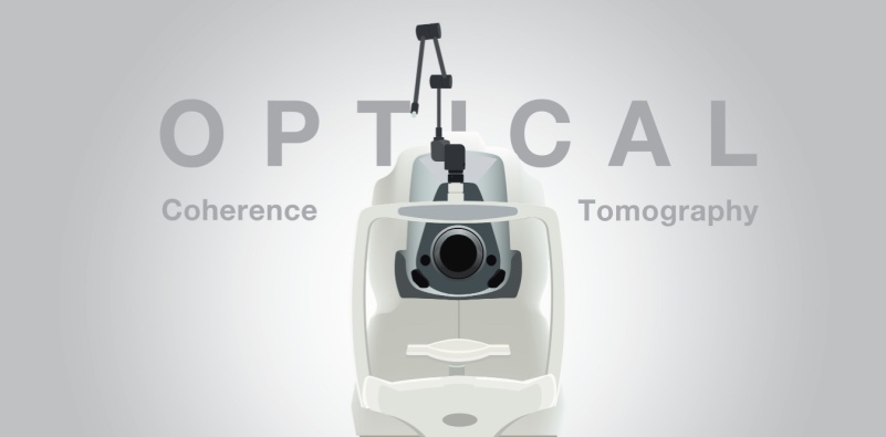 Image of an optical coherence tomography machine with the text ‘Optical Coherence Tomography.