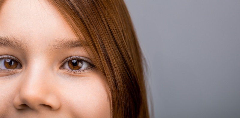 A young child with strabismus, showing one eye turned inwards.